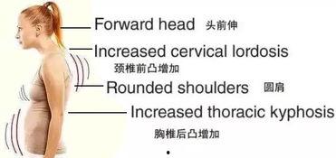 成人驼背正骨复位视频大全,成人驼背正骨复位视频大全解析